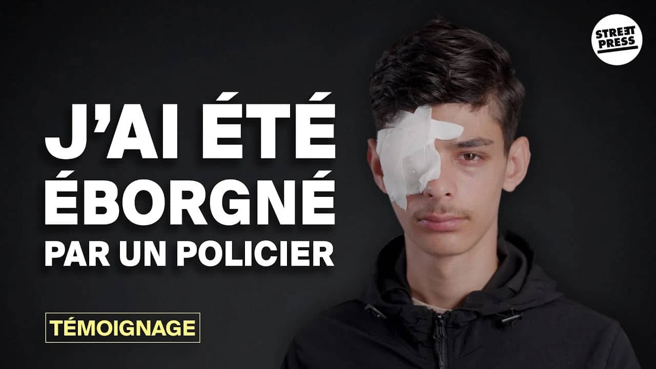 Déclaration choquante : Un jeune algérien victime d'une grave blessure à l'œil suite à une intervention policière en France Déclaration choquante : Un jeune algérien victime d'une grave blessure à l'œil suite à une intervention policière en France