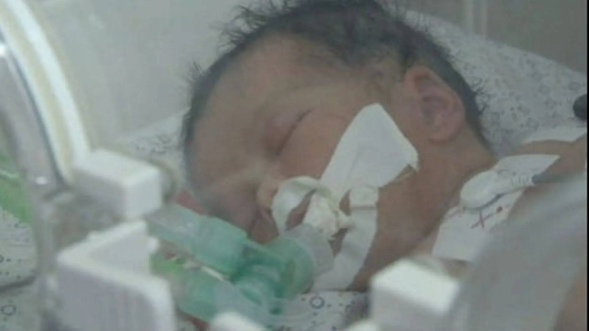 Gaza: une équipe médicale sort un enfant vivant du ventre de sa mère morte