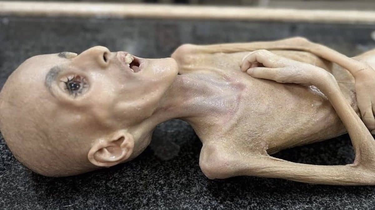 Histoire tragique de Yazen Al Kafarneh : un enfant de 10 ans décédé de faim à Gaza