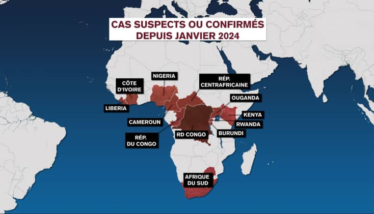 Variole du Singe : L'Algérie intensifie ses mesures préventives Variole du Singe : L'Algérie intensifie ses mesures préventives