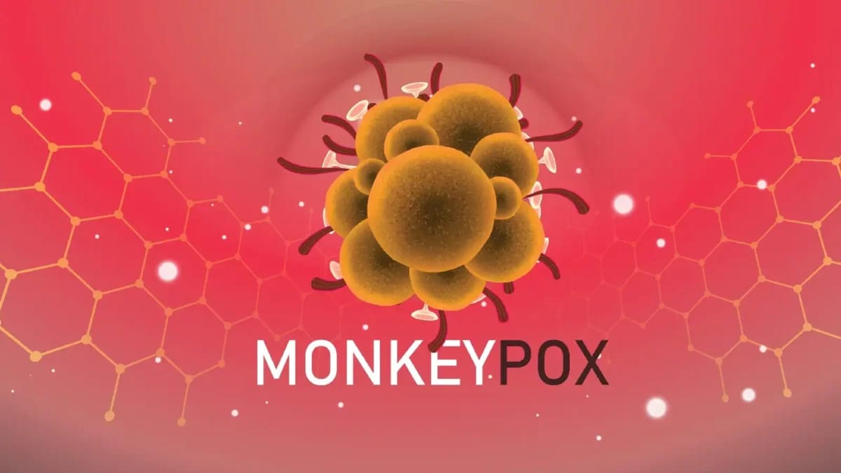Monkeypox