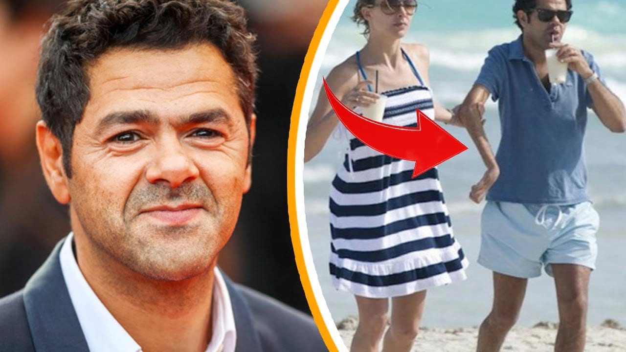 Jamel Debbouze Main: Tout savoir sur l'accident qui a coûté l’usage de son bras