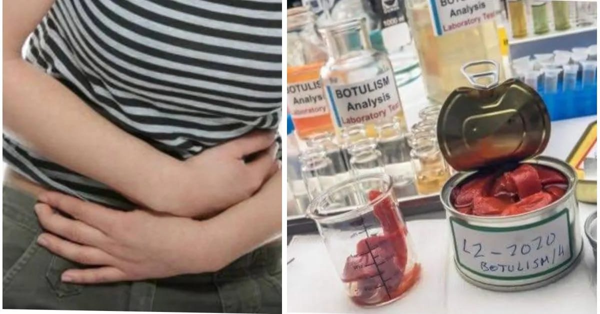 Alerte! Cas de botulisme en Algérie