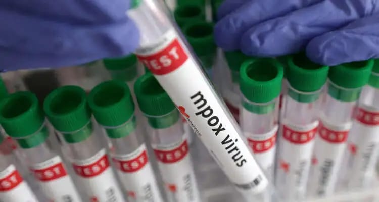 Urgent ! La CAN 2025 au Maroc menacée