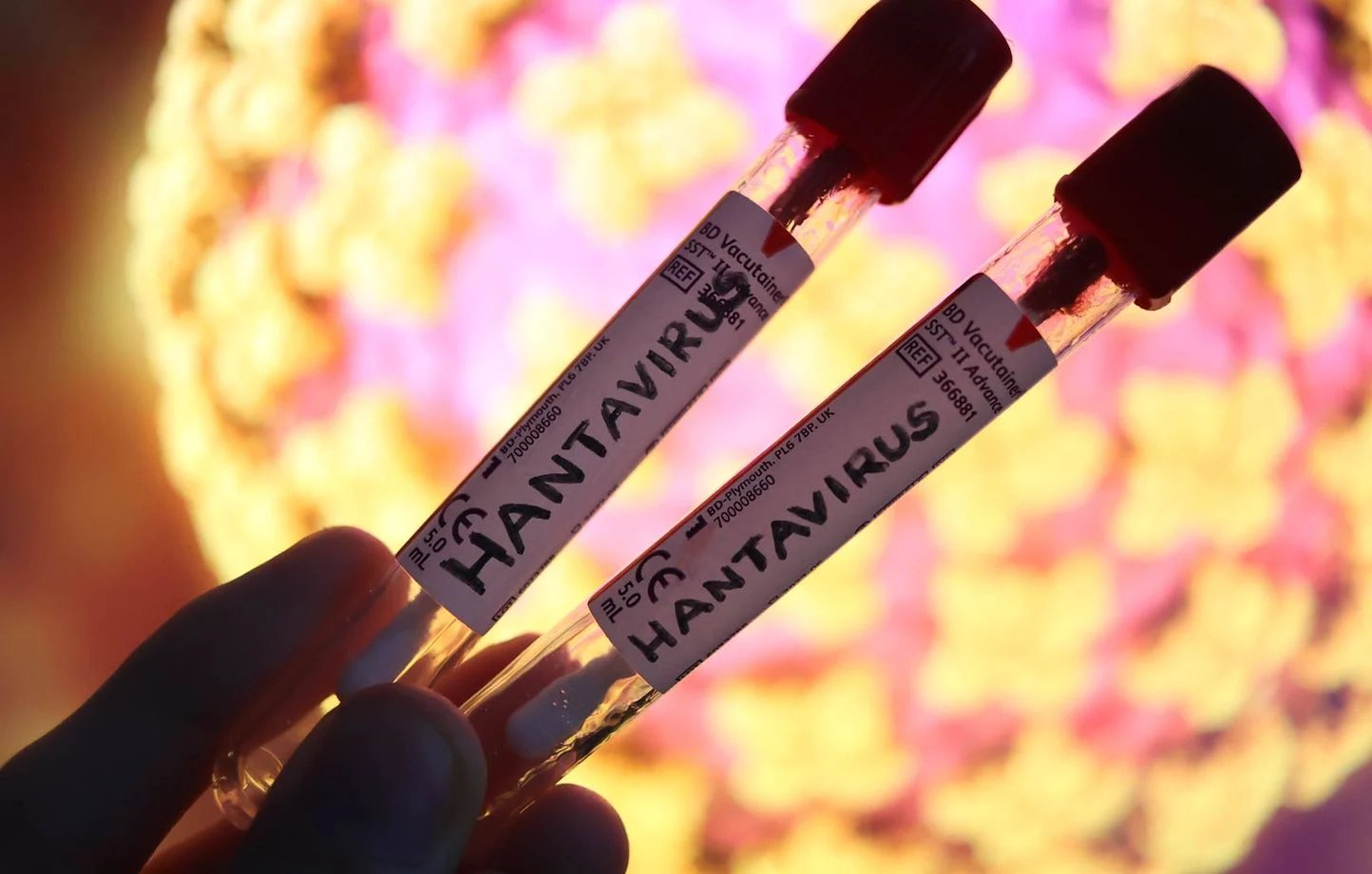 Hantavirus : l'Algérie active son dispositif sanitaire