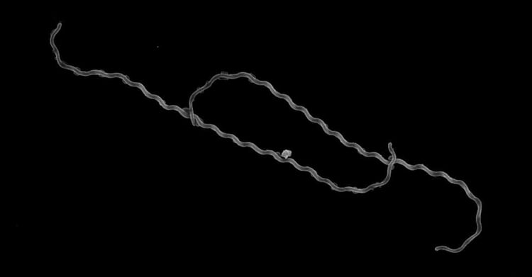 Une trentaine de cas de leptospirose ont été signalés à Tizi-Ouzou. Les autorités sanitaires rassurent : la situation est sous contrôle et des mesures de prévention sont mises en place pour limiter les risques de transmission.