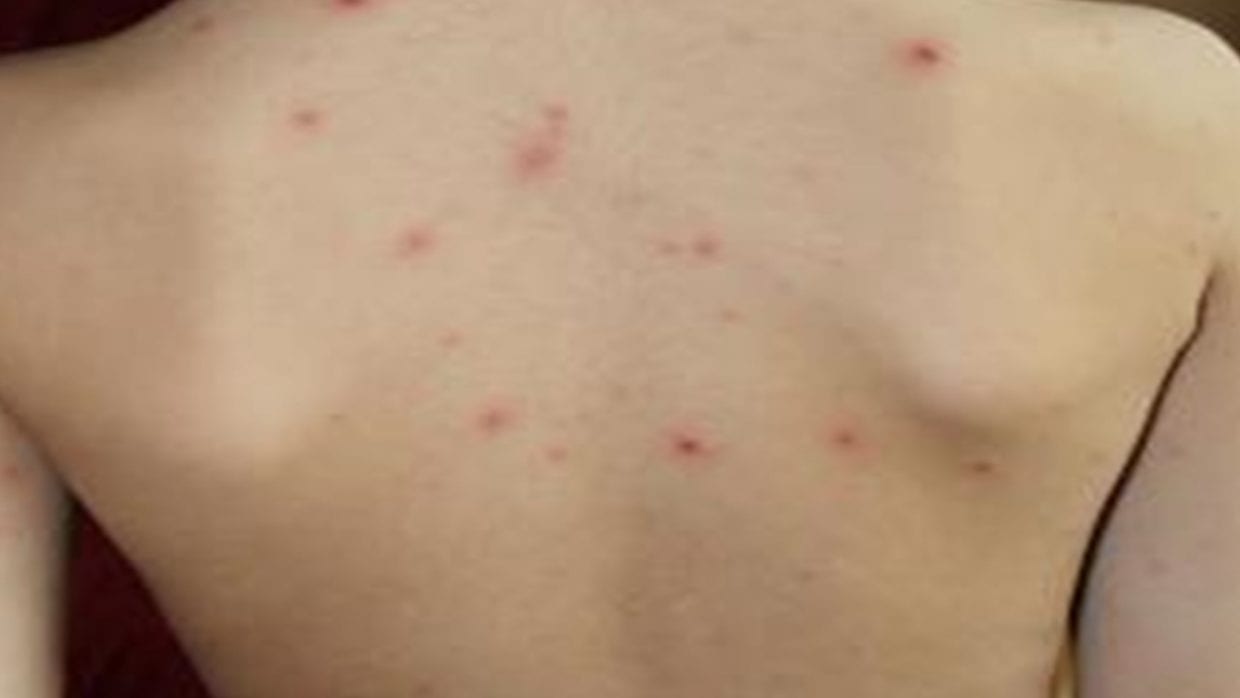 Gale en Algérie : alerte dans plusieurs écoles du pays