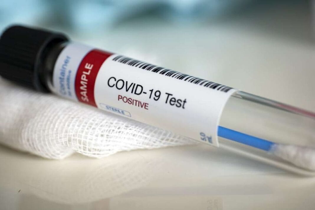 Covid-19 en Algérie : nouveaux records historique de contaminations et de décès Tube de test COVID-19 positif sur un chiffon blanc.