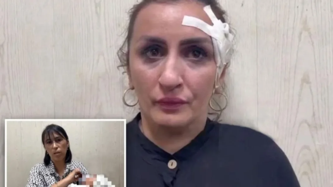 Une mère vend son enfant pour une opération esthétique du nez Femme avec bandage sur le nez après opération esthétique.