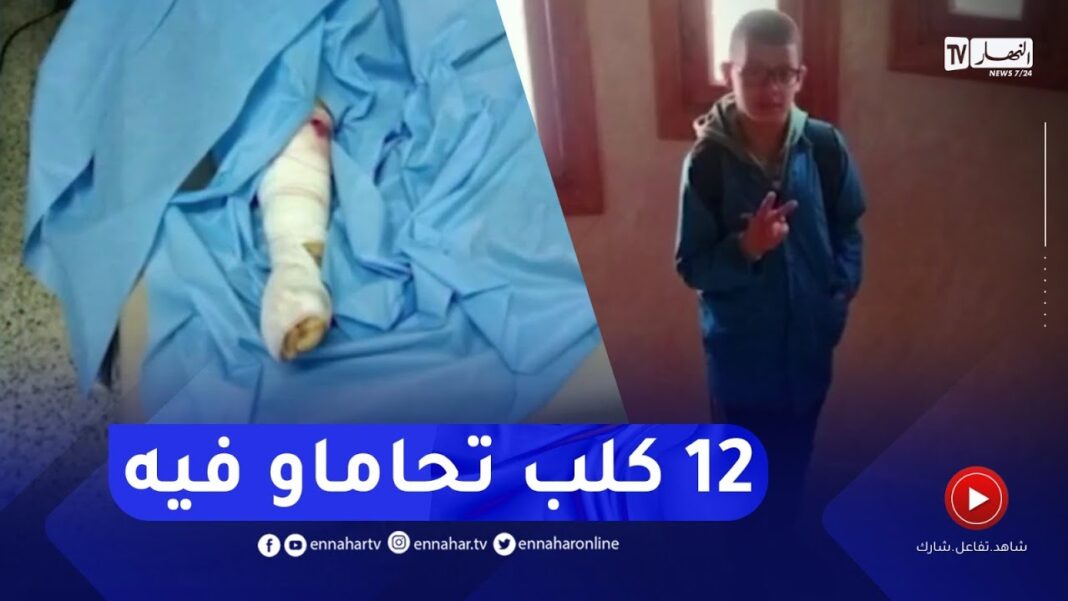Algérie : un enfant meurt après l’attaque de 12 chiens errants à Batna Enfant blessé avec un bras en bandage après une attaque de chiens errants.