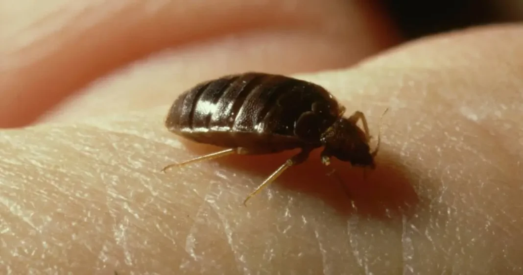 France: Prolifération des punaises de lits Punaises de lit, insecte nuisible, sur la peau humaine.