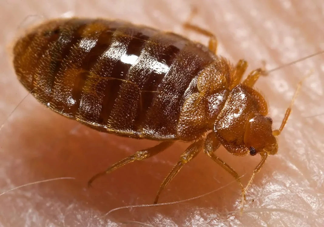 Et ça repart! Les punaises de lit refont surface en France Punaises de lit sur peau humaine, infestation domestique.