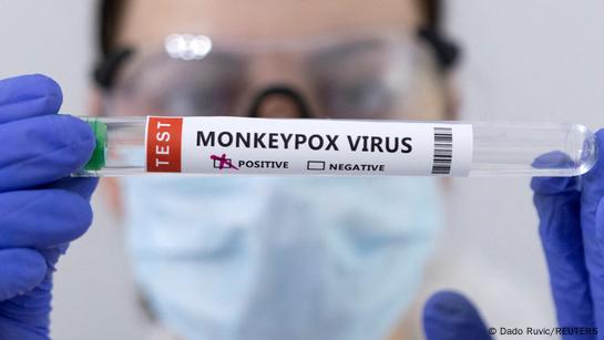 l’épidémie de mpox