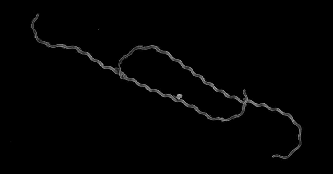 Leptospirose en Algérie : alerte à Tizi-Ouzou Bactéries en forme de spirale, causant la leptospirose en Algérie.